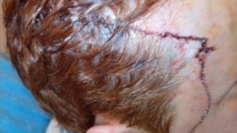 Herida de gravedad por un dron en&nbsp;Guipúzcoa